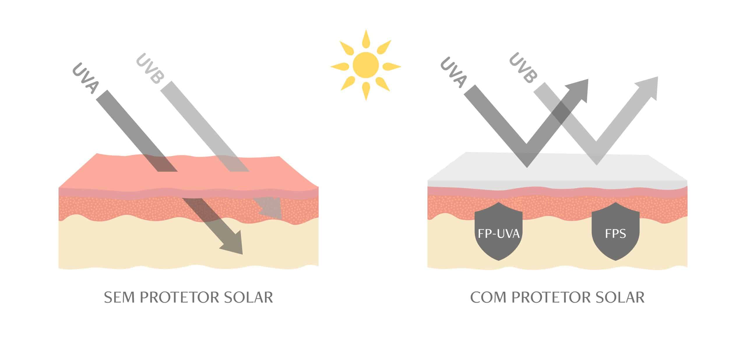 Imagem ilustrando de que forma os raios UVA e UVB atingem na pele sem protetor solar e com protetor solar. Imagem comparativa.